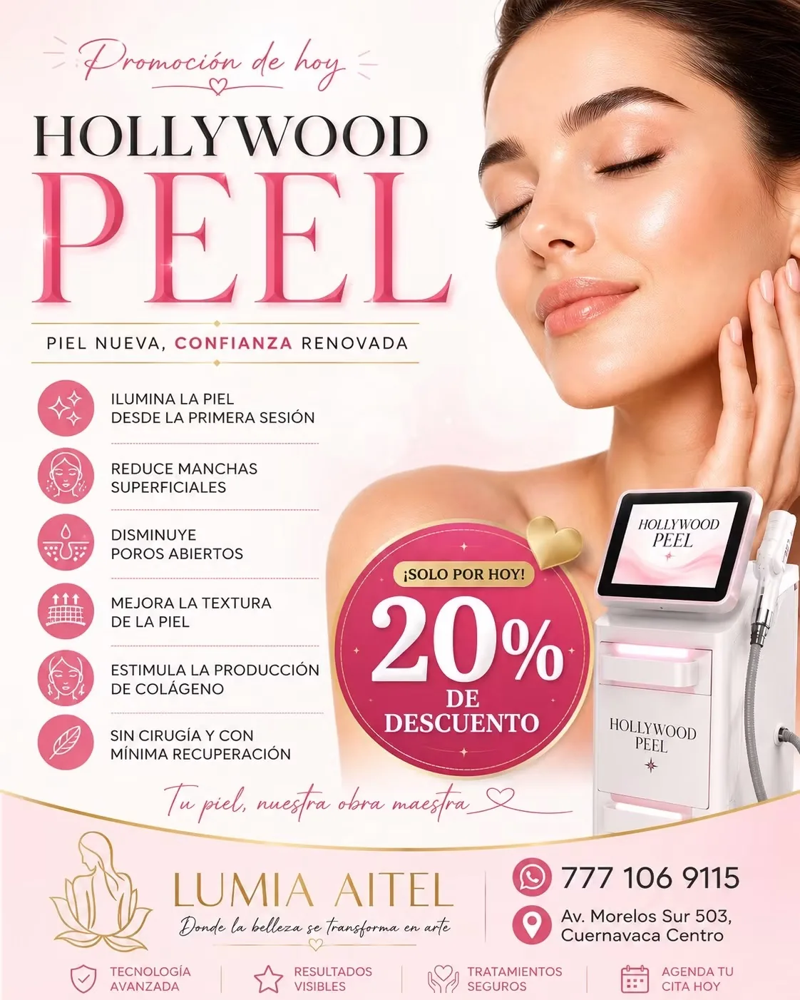 Hollywood Peel en Lumia Aitel